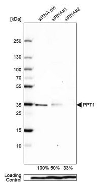 Anti-PPT1 antibody produced in rabbit Prestige Antibodies&#174; Powered by Atlas Antibodies, affinity isolated antibody, buffered aqueous glycerol solution