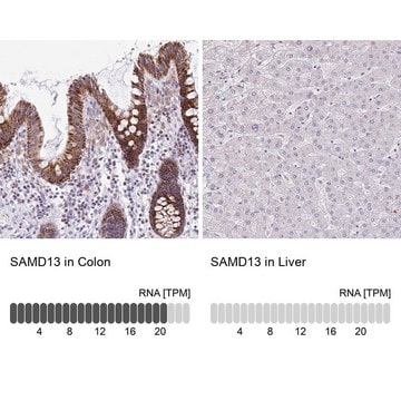 Anti-SAMD13 antibody produced in rabbit Prestige Antibodies&#174; Powered by Atlas Antibodies, affinity isolated antibody, buffered aqueous glycerol solution