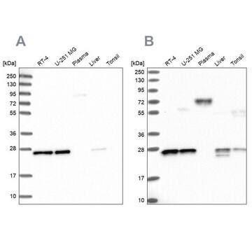 Anti-MESDC2 antibody produced in rabbit Prestige Antibodies&#174; Powered by Atlas Antibodies, affinity isolated antibody, buffered aqueous glycerol solution