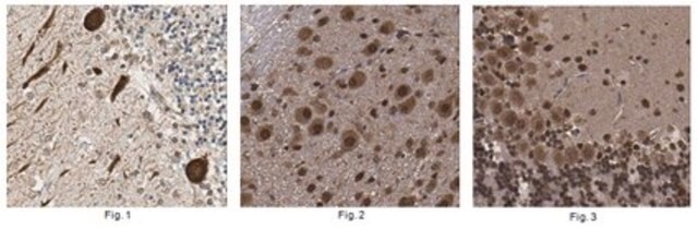 Anti-YY1AP1-Antikörper from rabbit, purified by affinity chromatography