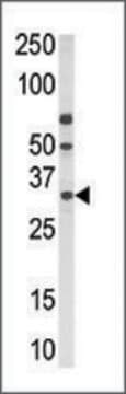 Anti-PPT2 (N-term) antibody produced in rabbit IgG fraction of antiserum, buffered aqueous solution