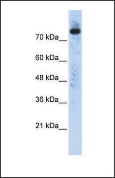 Anti-PLD2 affinity isolated antibody