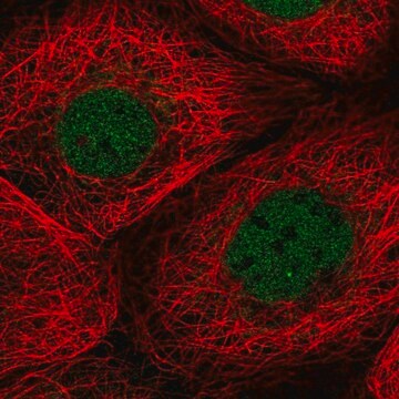 Anti-TMEM94 antibody produced in rabbit Prestige Antibodies&#174; Powered by Atlas Antibodies, affinity isolated antibody