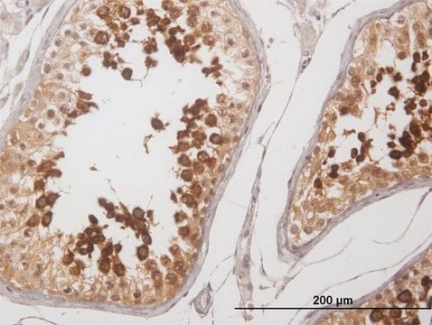 Anti-YBX2 antibody produced in mouse purified immunoglobulin, buffered aqueous solution