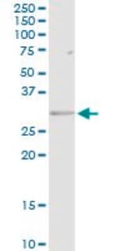 Anti-HLA-DRB5 antibody produced in rabbit purified immunoglobulin, buffered aqueous solution