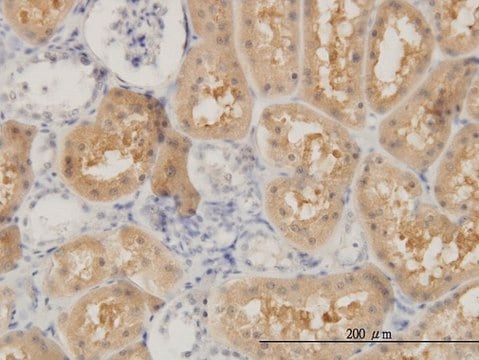 Monoclonal Anti-OCRL antibody produced in mouse clone 4A6, purified immunoglobulin, buffered aqueous solution