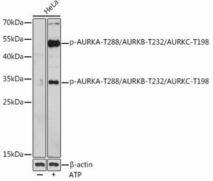 Anti-Phospho-AURKA-T288/AURKB-T232/AURKC-T198 antibody produced in rabbit