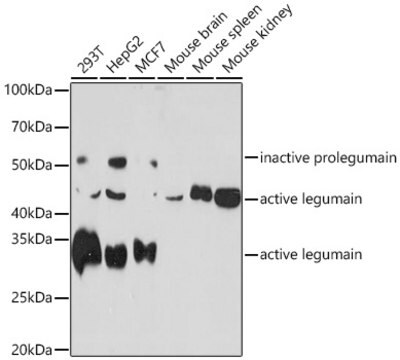 Anti-Legumain (LGMN) Antibody, clone 6X5U6, Rabbit Monoclonal