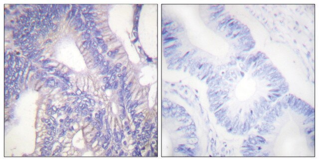 Anti-LYN antibody produced in rabbit affinity isolated antibody