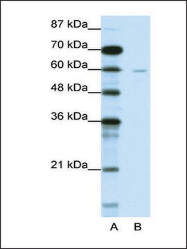 Anti-DCP1A (AB2) antibody produced in rabbit IgG fraction of antiserum