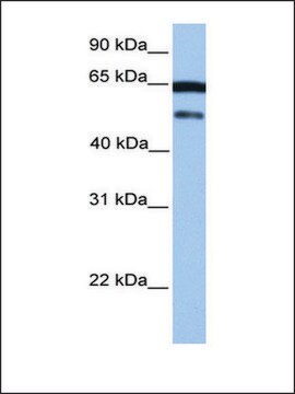 Anti-HCG_2042202 antibody produced in rabbit affinity isolated antibody