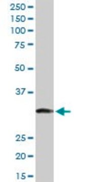 Anti-ITPK1 antibody produced in rabbit purified immunoglobulin, buffered aqueous solution