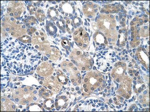 Anti-FBXO25 IgG fraction of antiserum