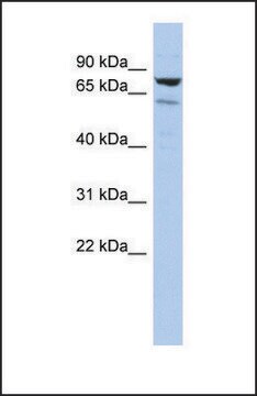 Anti-C1ORF103 antibody produced in rabbit affinity isolated antibody