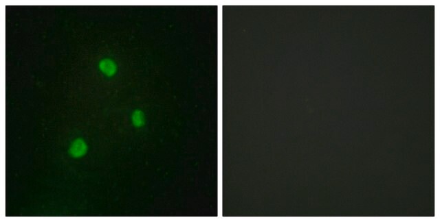 Anti-TBX1, C-Terminal antibody produced in rabbit affinity isolated antibody