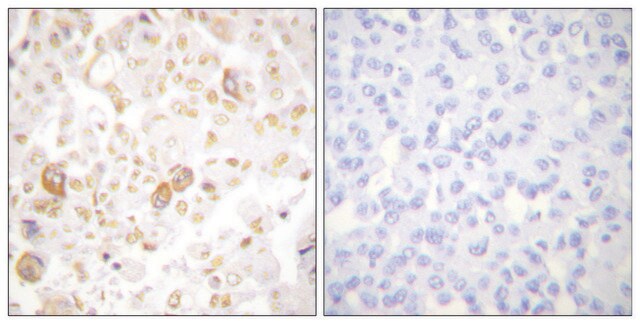 Anti-Cyclin F antibody produced in rabbit affinity isolated antibody