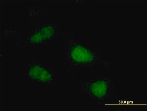 Anti-SIVA antibody produced in mouse IgG fraction of antiserum, buffered aqueous solution