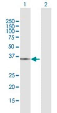 Anti-QPRT antibody produced in rabbit purified immunoglobulin, buffered aqueous solution