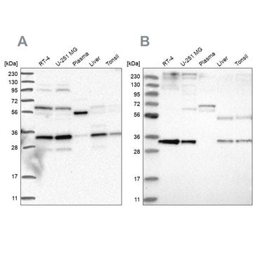 Anti-PPCS antibody produced in rabbit Prestige Antibodies&#174; Powered by Atlas Antibodies, affinity isolated antibody, buffered aqueous glycerol solution