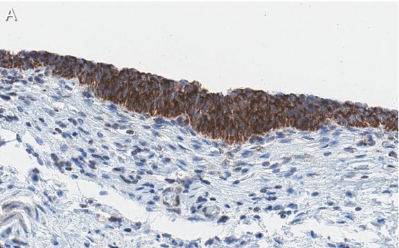 Anti-Bak Antibody, clone 2D18 ZooMAb&#174; Rabbit Monoclonal recombinant, expressed in HEK 293 cells