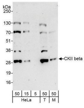 Rabbit anti-CKII beta Antibody, Affinity Purified Powered by Bethyl Laboratories, Inc.