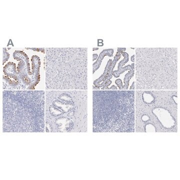 Anti-CFAP57 antibody produced in rabbit Prestige Antibodies&#174; Powered by Atlas Antibodies, affinity isolated antibody, buffered aqueous glycerol solution