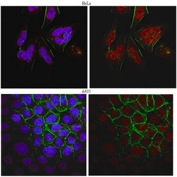 Anti-BRCA1 Antibody, clone MS13 clone MS13, from mouse