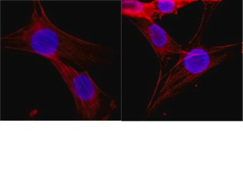 Anticuerpo anti-histona, clon H11-4 clone H11-4, Chemicon&#174;, from mouse