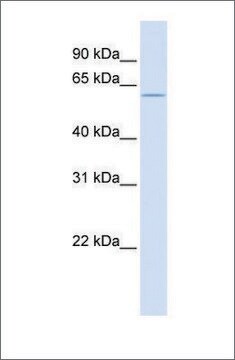 Anti-ZNF703 (ab1) antibody produced in rabbit affinity isolated antibody