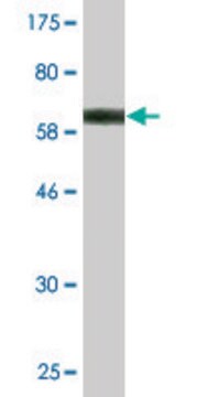 Monoclonal Anti-HGD antibody produced in mouse clone 1F1, purified immunoglobulin, buffered aqueous solution