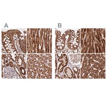 Anti-ATP5A1 antibody produced in rabbit Prestige Antibodies&#174; Powered by Atlas Antibodies, affinity isolated antibody, buffered aqueous glycerol solution