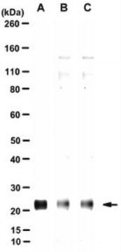 Anti-GINS1 Antibody, clone 192B