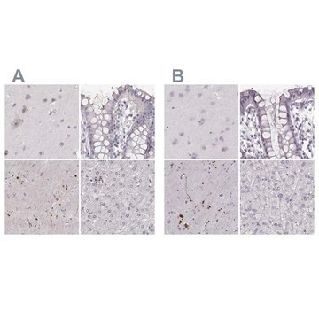 Anti-RUNDC3A antibody produced in rabbit Prestige Antibodies&#174; Powered by Atlas Antibodies, affinity isolated antibody