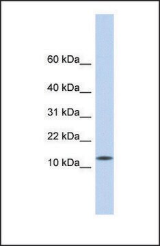 Anti-CDRT4 antibody produced in rabbit affinity isolated antibody