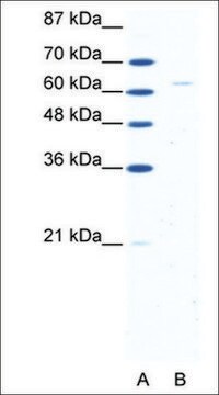 Anti-FOXN1 IgG fraction of antiserum