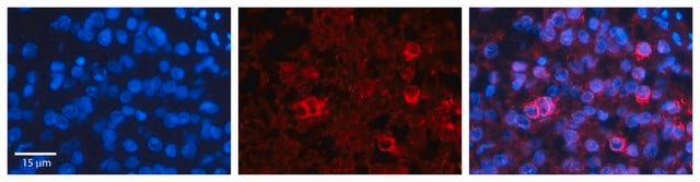 Anti-PTGS1 (AB1) antibody produced in rabbit affinity isolated antibody