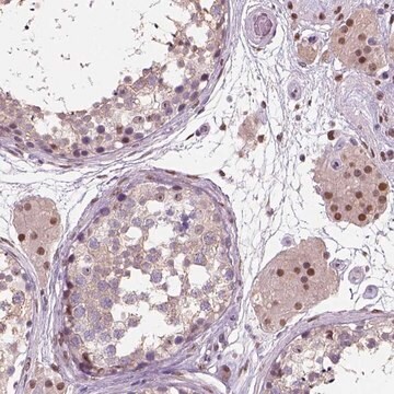 Anti-C1orf112 antibody produced in rabbit Prestige Antibodies&#174; Powered by Atlas Antibodies, affinity isolated antibody, buffered aqueous glycerol solution, Ab1