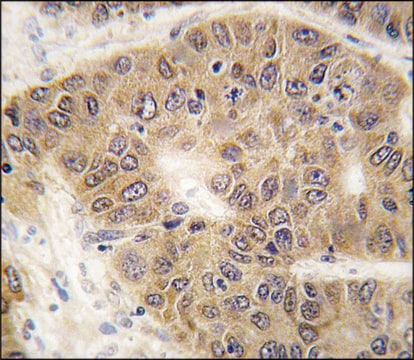 Anti-SUMO4 (V55 Mutant) antibody produced in rabbit saturated ammonium sulfate (SAS) precipitated, buffered aqueous solution