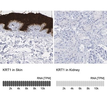 抗KRT1抗体 ウサギ宿主抗体 Prestige Antibodies&#174; Powered by Atlas Antibodies, affinity isolated antibody, buffered aqueous glycerol solution