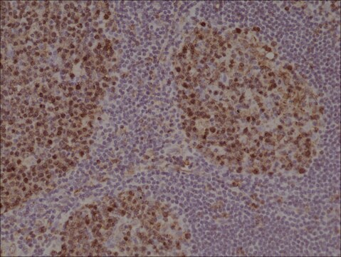 Anti-Stathmin (CTMN1) antibody, Rabbit monoclonal recombinant, expressed in HEK 293 cells, clone RM350, purified immunoglobulin