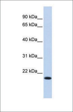 Anti-IRF7 antibody produced in rabbit affinity isolated antibody