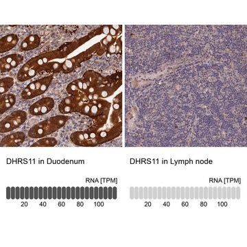 Anti-DHRS11 antibody produced in rabbit Prestige Antibodies&#174; Powered by Atlas Antibodies, affinity isolated antibody, buffered aqueous glycerol solution