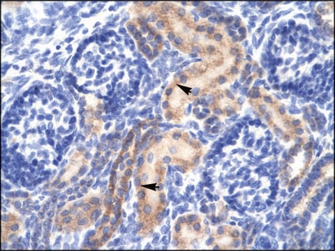 Anti-PCK1 (AB2) antibody produced in rabbit affinity isolated antibody