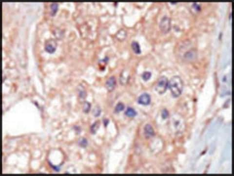 Anti-KIS (N-term) antibody produced in rabbit IgG fraction of antiserum, buffered aqueous solution