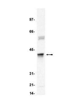 Anti-Clusterin &#945; chain (human) Antibody, clone 41D clone 41D, Upstate&#174;, from mouse