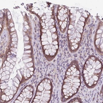 Anti-TMEM108 antibody produced in rabbit Prestige Antibodies&#174; Powered by Atlas Antibodies, affinity isolated antibody, buffered aqueous glycerol solution