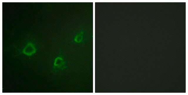 Anti-PLCG1 antibody produced in rabbit affinity isolated antibody