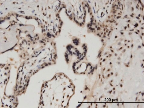 Monoclonal Anti-BCL11A antibody produced in mouse clone 3D9, purified immunoglobulin, buffered aqueous solution