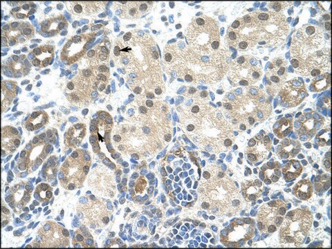 Anti-PPIE (AB2) antibody produced in rabbit IgG fraction of antiserum