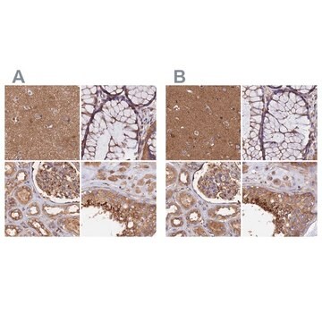 Anti-DCTN2 antibody produced in rabbit Prestige Antibodies&#174; Powered by Atlas Antibodies, affinity isolated antibody, buffered aqueous glycerol solution